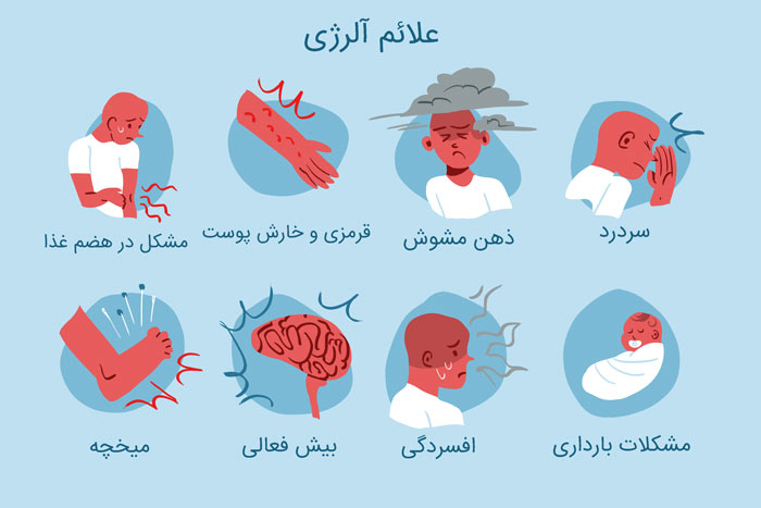 آلرژی