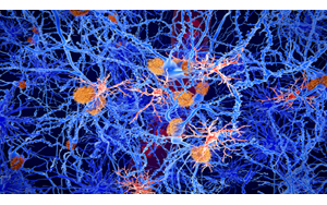 درمانی نوآورانه برای صرع که حافظه را بازیابی و از تشنج جلوگیری می‌کند