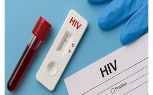 از تغییر الگوی انتقال تا دسترسی وسیع به درمان؛ تصویر امروز HIV در ایران