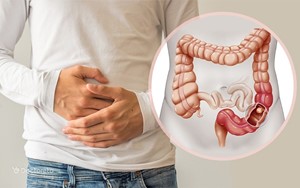 آیا عبور مدفوع در روده بر سلامت ما تاثیر میگذارد؟