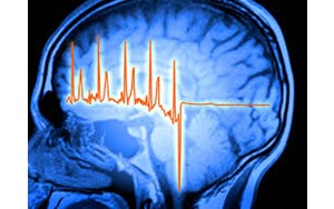 کشف ارتباط شگفت‌انگیز مغز و قلب در بهبود پس از سکته قلبی