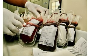 بررسی کیفیت خون اهدایی در عرض تنها ۲ دقیقه