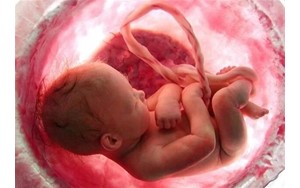 ناباروری و سقط جنین و افزایش ریسک سکته