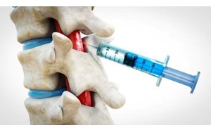 امکان ترمیم اعصاب نخاع با تزریق یک دوز ژل نانویی