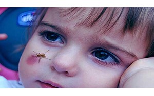 دلیل اینکه پشه ‌های ناقل مالاریا، انسان را بیشتر نیش می ‌زنند، چیست؟