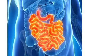 علت کاهش سن ابتلا به سرطان روده بزرگ مشخص شد