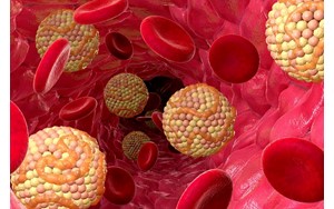 درمان ژنی تازه‌ای که می‌تواند کلسترول را برای همیشه از بین ببرد