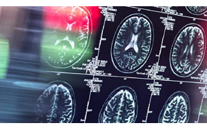 تأثیر عوامل روزانه بر شکل‌گیری عادت مغزی کشف شد