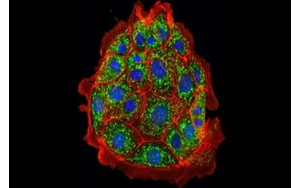 دانشمندان آسیب کلیوی را در موش‌ها معکوس کردند
