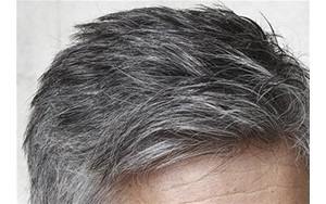 سفید شدن موها می‌تواند خبر خوبی برای سلامت شما باشد