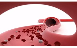 بالا بودن تعداد پلاکت خون می‌تواند منجر به مشکلات جدی سلامتی شود؟