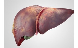 5 نشانه روی صورت که می‌تواند نشان‌دهنده کبد چرب باشد