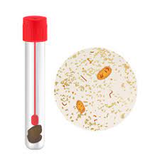 Stool Exam (SE)