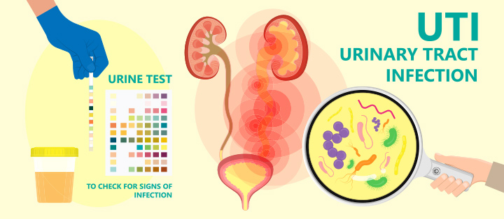 Symptoms-Of-Urinary-Tract-Infection