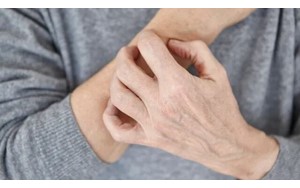 نشانه‌های پوستی که نباید نادیده بگیرید